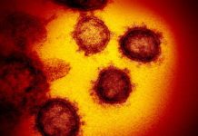 Laboratório particular confirma 3º caso positivo de coronavírus em Nova Guataporanga