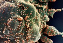 Casos de coronavírus confirmados na região de Presidente Prudente em 10 de junho