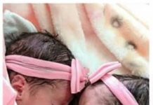 Recém-nascidas gêmeas morrem após serem atacadas por cachorro da família no sudoeste da Bahia