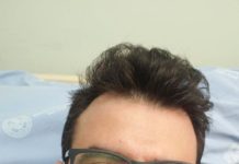 Diagnosticado com COVID, médico nascido em Dracena relata como foi o drama de conviver com a doença