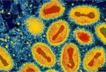 Monte Castelo registra mais um óbito causado pelo novo coronavírus