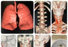 Tomógrafo da Santa Casa de Dracena já realizou 89 exames em dez dias